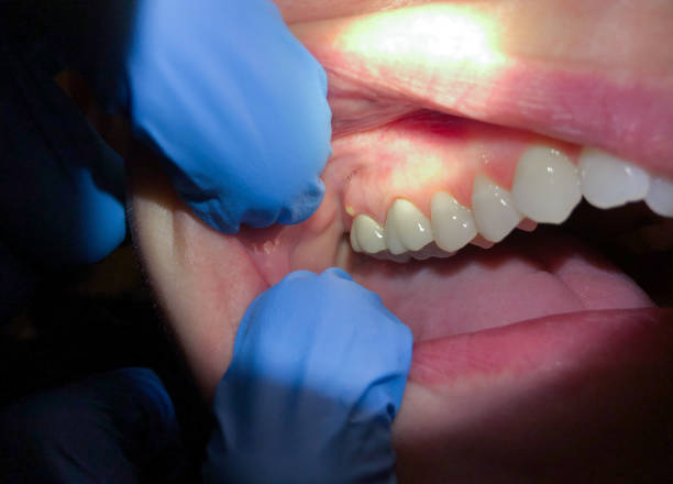 Best Dentist for Dental Trauma  in Florence, SC