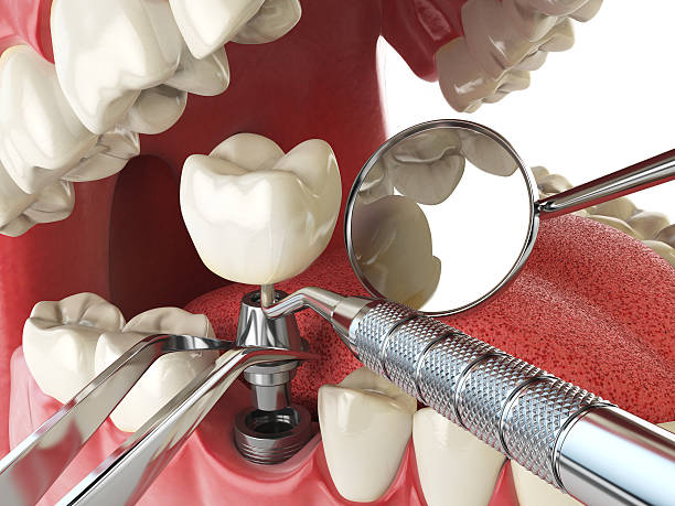 Best Knocked-Out Tooth Emergency  in Florence, SC
